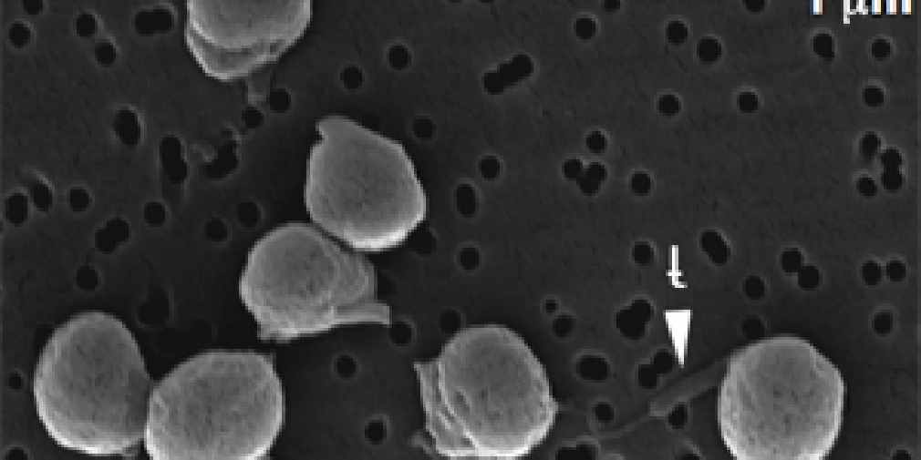 Micromonas : des sentinelles dans un océan qui se réchauffe.