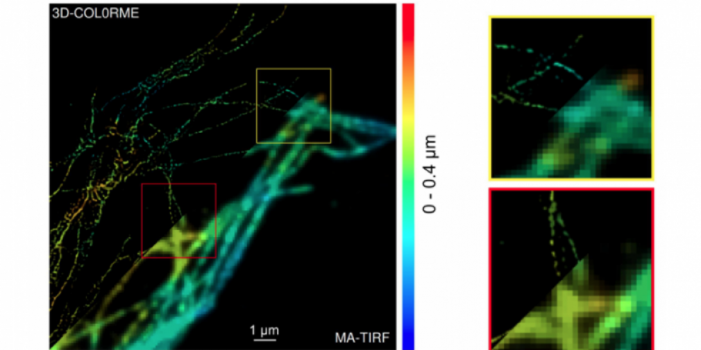 Une méthode qui permet une résolution inégalée des images acquises par un microscope de fluorescence par réflexion totale interne (TIRF)